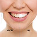 Bleek Strips - VOOR EN NA